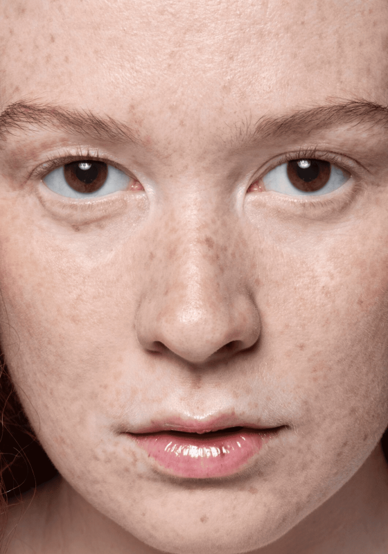 Medicina estética regenerativa en Piedras Blancas y Madrid como enfoque diferencial en rejuvenecimiento facial