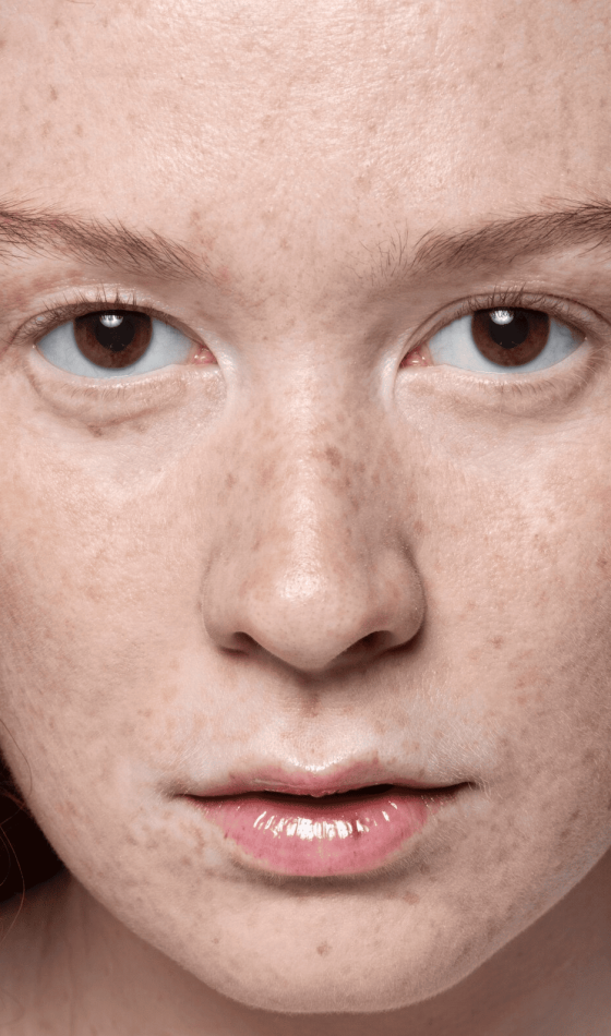 Medicina estética regenerativa en Piedras Blancas y Madrid como enfoque diferencial en rejuvenecimiento facial