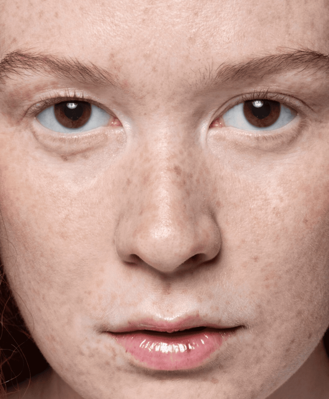Medicina estética regenerativa en Piedras Blancas y Madrid como enfoque diferencial en rejuvenecimiento facial